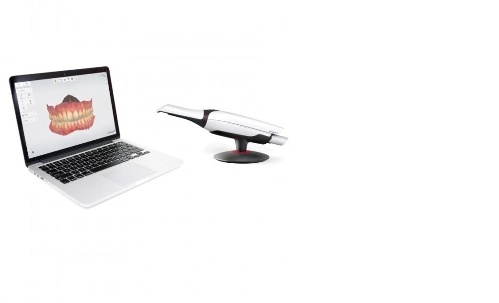 Digital Scanner